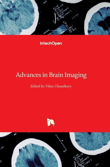 Cover for Vikas Chaudhary · Advances in Brain Imaging (Innbunden bok) (2012)