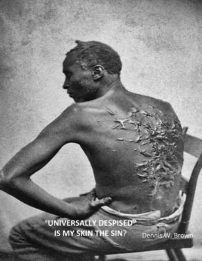Cover for Dennis Brown · Universally Despised Is My Skin the Sin? (Paperback Book) (2021)