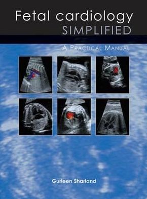 Fetal Cardiology Simplified: A Practical Manual - Dr Gurleen Sharland - Książki - TFM Publishing Ltd - 9781903378557 - 1 grudnia 2012