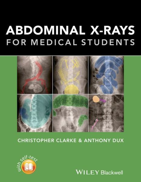Cover for Clarke, Christopher (Nottingham University Hospitals) · Abdominal X-rays for Medical Students (Paperback Book) (2015)