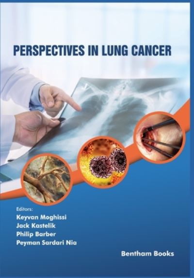 Perspectives in Lung Cancer - Jack Kastelik - Books - Bentham Science Publishers - 9789811459559 - July 30, 2020