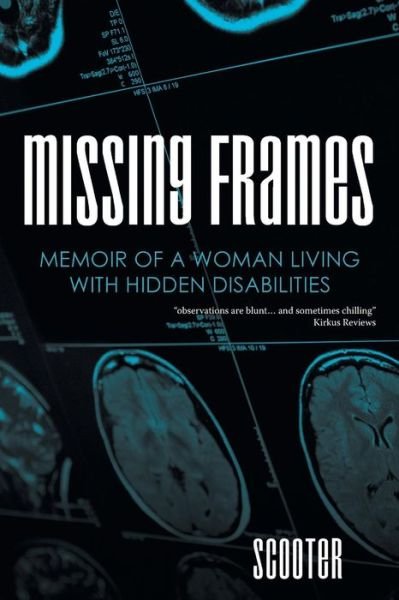 Cover for Scooter · Missing Frames (Paperback Bog) (2015)