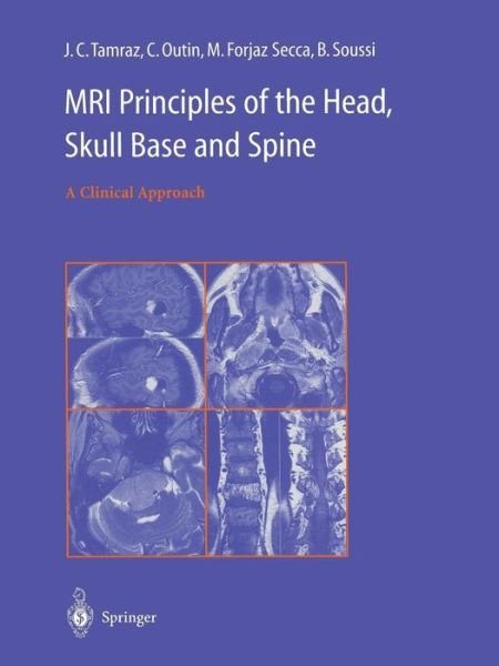 Cover for J.C. Tamraz · MRI Principles of the Head, Skull Base and Spine: A Clinical Approach (Paperback Book) [Softcover reprint of the original 1st ed. 2003 edition] (2013)