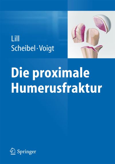 Cover for Lill  Helmut · Die Proximale Humerusfraktur (Hardcover Book) (2014)