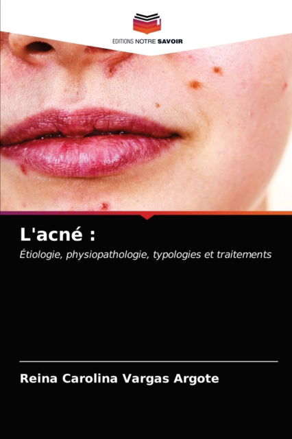 L'acne - Reina Carolina Vargas Argote - Books - Editions Notre Savoir - 9786203482560 - March 16, 2021