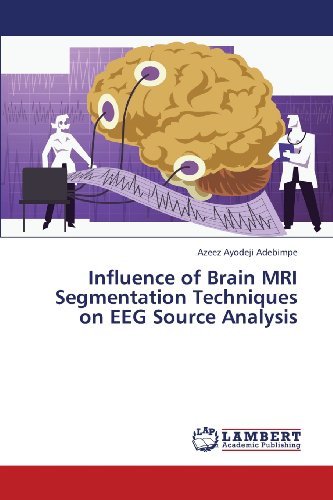 Cover for Azeez Ayodeji Adebimpe · Influence of Brain Mri Segmentation Techniques  on Eeg Source Analysis (Pocketbok) (2013)