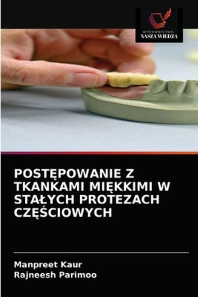 Cover for Manpreet Kaur · Post?powanie Z Tkankami Mi?kkimi W Stalych Protezach Cz??ciowych (Paperback Book) (2021)