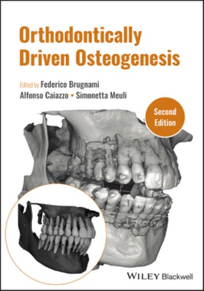 Brugnami · Orthodontically Driven Osteogenesis (Hardcover Book) (2024)