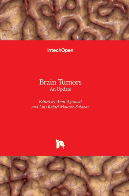 Brain Tumors - Amit Agrawal - Books - IntechOpen - 9781789235562 - August 22, 2018