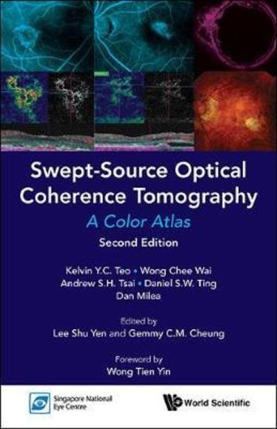 Cover for Teo, Kelvin Yi Chong (S'pore National Eye Centre, S'pore) · Swept-source Optical Coherence Tomography: A Color Atlas (Paperback Book) [Second edition] (2018)