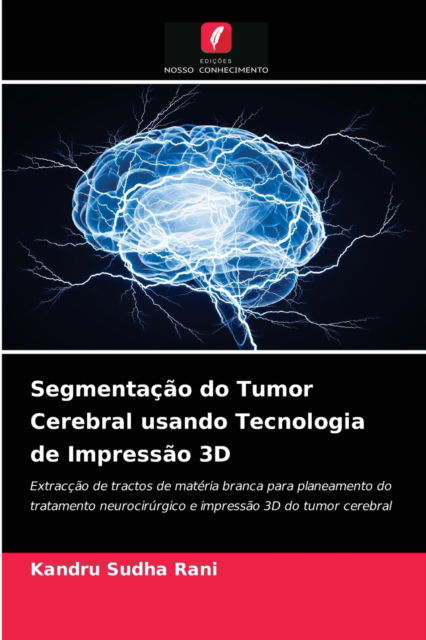 Cover for Kandru Sudha Rani · Segmentacao do Tumor Cerebral usando Tecnologia de Impressao 3D (Paperback Book) (2021)