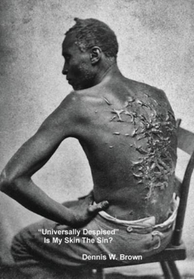 Universally Despised Is My Skin The Sin? - Dennis Brown - Livros - African American Antiquity - 9780578979564 - 1 de setembro de 2021