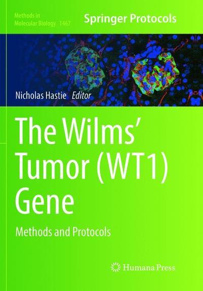 Cover for The Wilms' Tumor (WT1) Gene: Methods and Protocols - Methods in Molecular Biology (Paperback Book) [Softcover reprint of the original 1st ed. 2016 edition] (2018)