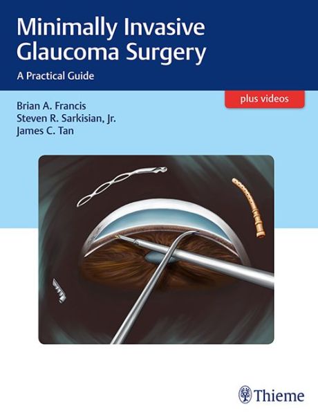 Cover for Brian Francis · Minimally Invasive Glaucoma Surgery: A Practical Guide (Hardcover Book) (2016)