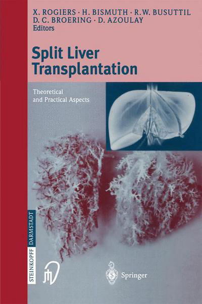 Cover for X Rogiers · Split liver transplantation: Theoretical and practical aspects (Taschenbuch) (2002)