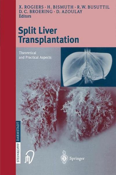 Cover for X Rogiers · Split liver transplantation: Theoretical and practical aspects (Paperback Bog) (2002)