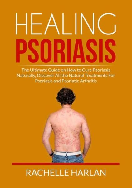 Cover for Rachelle Harlan · Healing Psoriasis: The Ultimate Guide on How to Cure Psoriasis Naturally, Discover All the Natural Treatments For Psoriasis and Psoriatic Arthritis (Pocketbok) (2021)