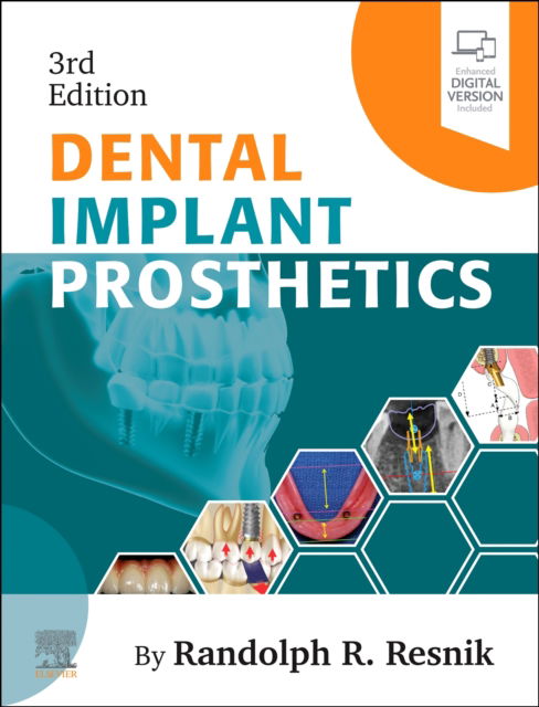 Cover for Resnik, Randolph (Private Practice, Resnik Dental Implants Taylor, MI Surgical Director, Misch|Resnik International Implant Institute Taylor, MI clinical professor of Oral Implantology, Temple University, USA) · Dental Implant Prosthetics (Hardcover Book) (2026)