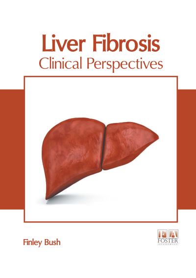 Cover for Finley Bush · Liver Fibrosis: Clinical Perspectives (Hardcover Book) (2020)