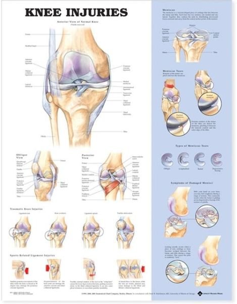 Cover for Anatomical Chart Com · Knee Injuries Anatomical Chart (Map) [New edition] (2004)