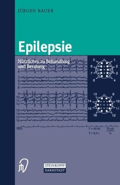 Cover for Bauer  J  Rgen · Epilepsie (Paperback Bog) [German, 2002 edition] (2002)