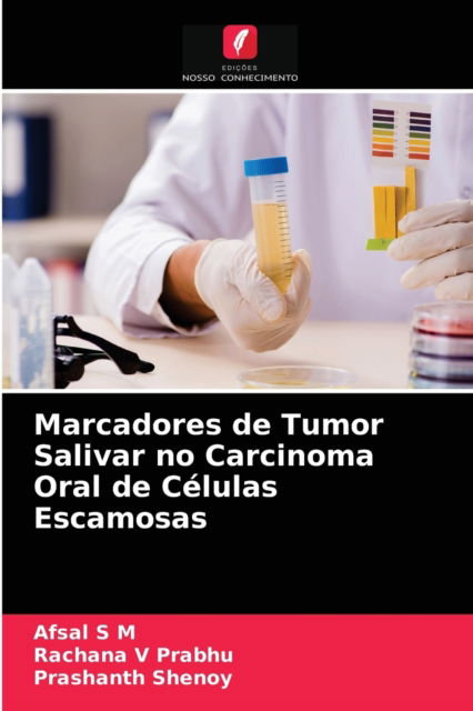 Cover for Afsal S M · Marcadores de Tumor Salivar no Carcinoma Oral de Celulas Escamosas (Paperback Book) (2021)