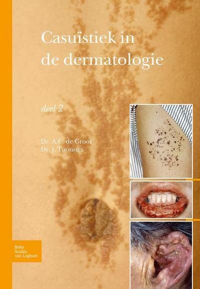 Casuistiek in de Dermatologie - Deel 2 - Johan Toonstra - Libros - Bohn,Scheltema & Holkema,The Netherlands - 9789031384570 - 3 de septiembre de 2010