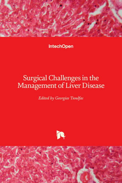Cover for Georgios Tsoulfas · Surgical Challenges in the Management of Liver Disease (Innbunden bok) (2019)