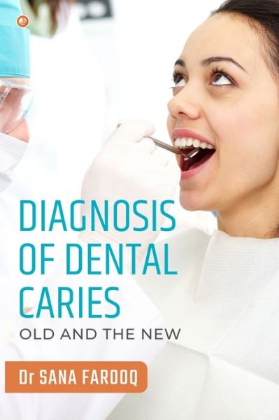 Cover for Sana Farooq · Diagnosis of Dental Caries-Old and the New (Paperback Book) (2022)