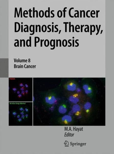 Cover for M a Hayat · Methods of Cancer Diagnosis, Therapy, and Prognosis: Brain Cancer - Methods of Cancer Diagnosis, Therapy and Prognosis (Paperback Book) [2011 edition] (2012)