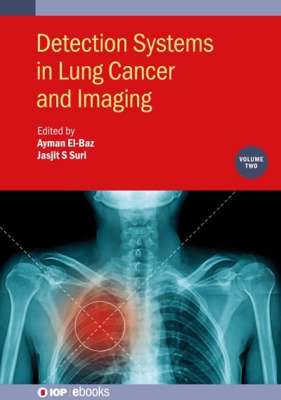 Cover for Ayman El-Baz · Detection Systems in Lung Cancer and Imaging, Volume 2 - IOP ebooks (Innbunden bok) (2024)