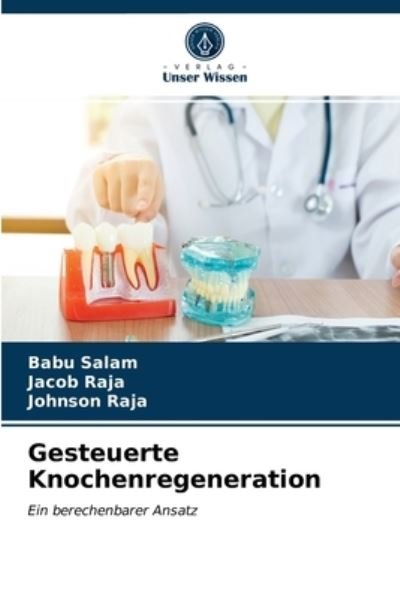 Cover for Babu Salam · Gesteuerte Knochenregeneration (Paperback Bog) (2021)