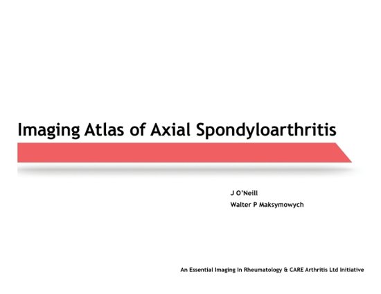 Cover for J O'Neill · Imaging Atlas of Axial Spondyloarthritis (Paperback Book) (2020)