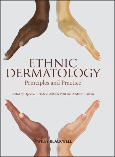 Cover for Ophelia E. Dadzie · Ethnic Dermatology: Principles and Practice (Inbunden Bok) (2013)