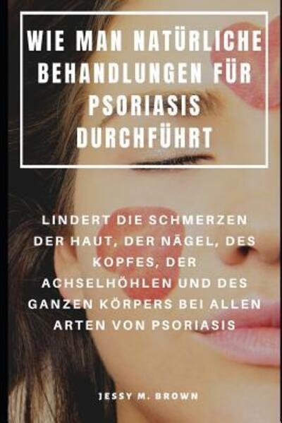 Cover for Jessy M Brown · Wie Man Naturliche Behandlungen Fur Psoriasis Durchfuhrt (Taschenbuch) (2019)