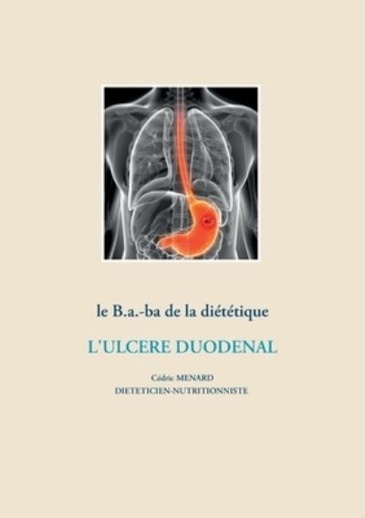 Cover for Cedric Menard · Le b.a.-ba de la dietetique pour l'ulcere duodenal (Taschenbuch) (2021)