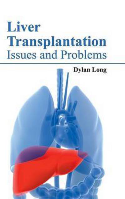 Cover for Dylan Long · Liver Transplantation: Issues and Problems (Hardcover Book) (2015)