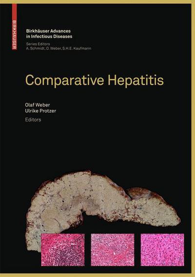 Cover for Comparative Hepatitis - Birkhauser Advances in Infectious Diseases (Hardcover Book) [2008 edition] (2008)