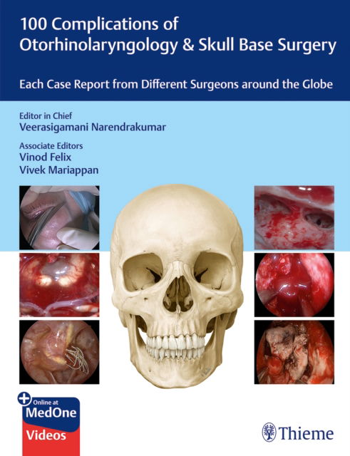 100 Complications of Otorhinolaryngology & Skull Base Surgery: Each Case Report from Different Surgeons around the Globe (N/A) (2024)