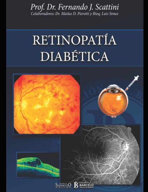Cover for Matias Pierotti · Retinopatia diabetica (Paperback Book) (2021)