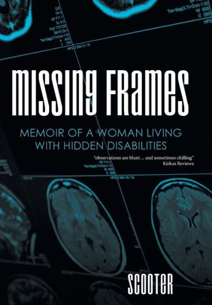 Cover for Scooter · Missing Frames (Inbunden Bok) (2015)