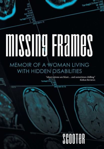 Cover for Scooter · Missing Frames (Hardcover Book) (2015)