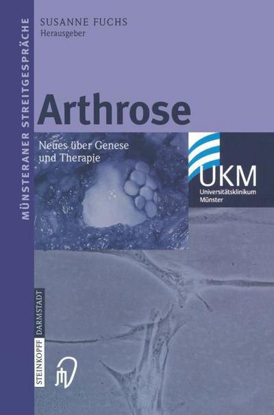 Cover for Susanne Fuchs · Arthrose : Neues Ã¯â¿â½ber Genese Und Therapie (Paperback Book) (2004)