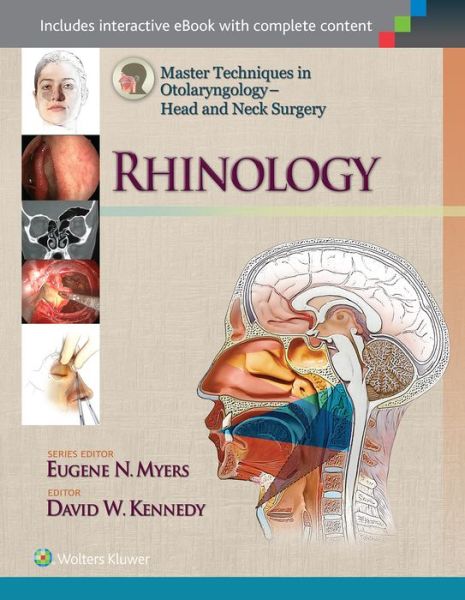 Cover for David Kennedy · Master Techniques in Otolaryngology - Head and Neck Surgery: Rhinology - Master Techniques in Otolaryngology Surgery (Hardcover Book) (2015)