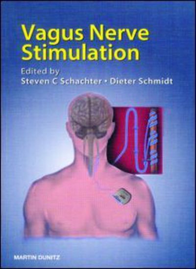 Cover for James Robertson · Vagus Nerve Stimulation (Paperback Book) (2002)