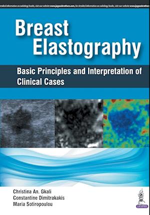 Cover for Christina An Gkali · Breast Elastography: Basic Principles and Interpretation of Clinical Cases (Gebundenes Buch) (2017)