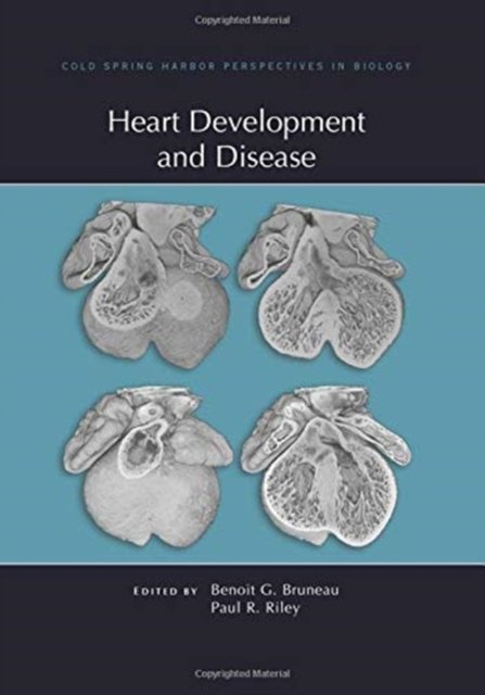 Cover for Benoit Bruneau · Heart Development and Disease - Perspectives Cshl (Hardcover bog) (2020)