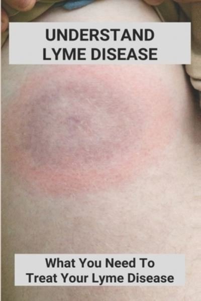 Cover for Lera Altaras · Understand Lyme Disease (Paperback Bog) (2021)