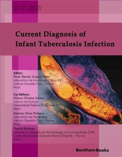 Cover for Dilvani Oliveira Santos · Current Diagnosis of Infant Tuberculosis Infection (Paperback Book) (2018)