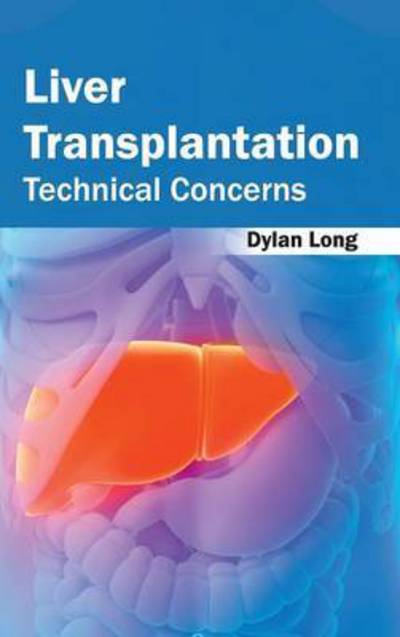 Cover for Dylan Long · Liver Transplantation: Technical Concerns (Hardcover Book) (2015)